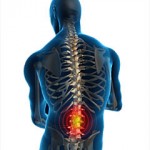 Lower Back Pain Relief